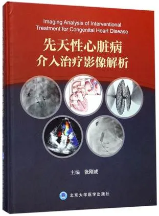 先天性心脏病介入治疗影像解析