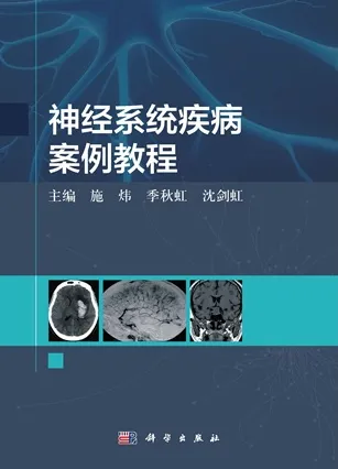 神经系统疾病案例教程
