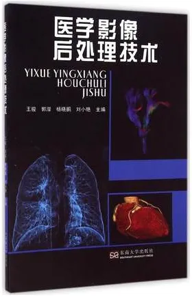 医学影像后处理技术