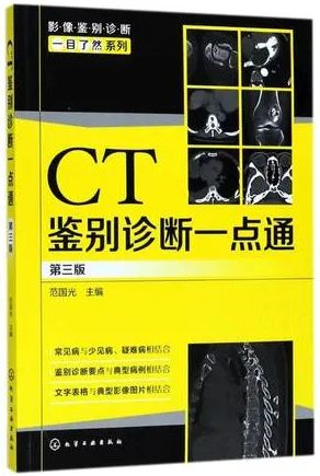 CT鉴别诊断一点通 第3版