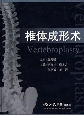 椎体成形术
