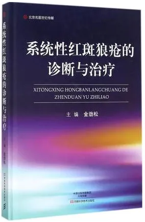 系统性红斑狼疮的诊断与治疗