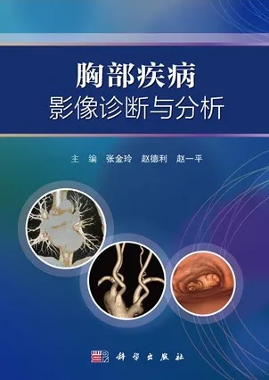 胸部疾病影像诊断与分析