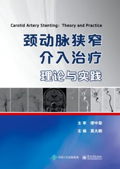 颈动脉狭窄介入治疗 理论与实践