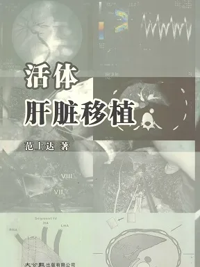 活体肝脏移植