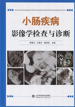 小肠疾病影像学检查与诊断