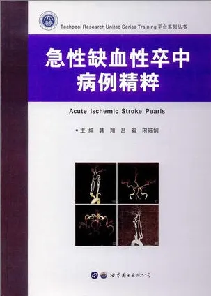 急性缺血性卒中病例精粹