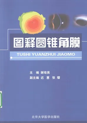 图释圆锥角膜