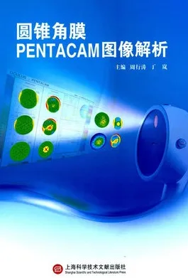 圆锥角膜PENTACAM图像解析