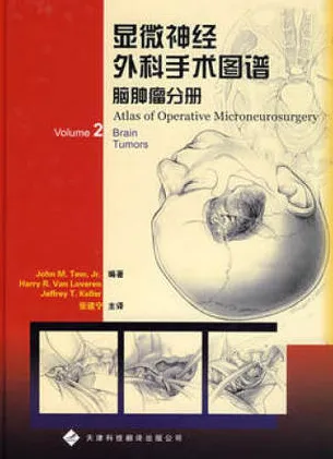 显微神经外科手术图谱 脑肿瘤分册