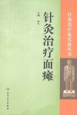 针灸治疗面瘫（2009）