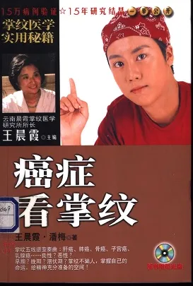 癌症看掌纹