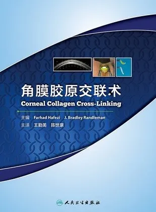 角膜胶原交联术