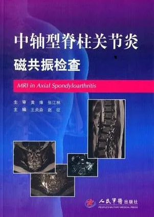 中轴型脊柱关节炎磁共振检查