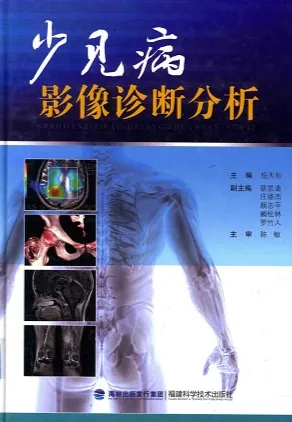 少见病影像诊断分析