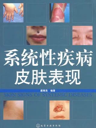 系统性疾病皮肤表现