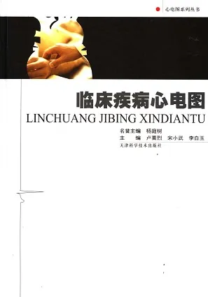临床疾病心电图