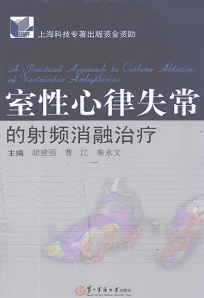 室性心律失常的射频消融治疗
