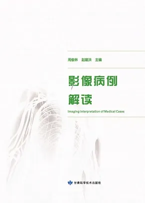影像病例解读
