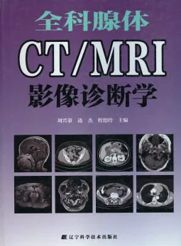 全科腺体CT MRI影像诊断学