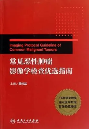 常见恶性肿瘤影像学检查优选指南
