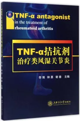 TNF-α拮抗剂治疗类风湿关节炎