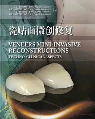 瓷贴面微创修复
