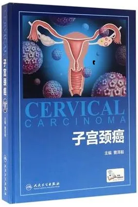子宫颈癌