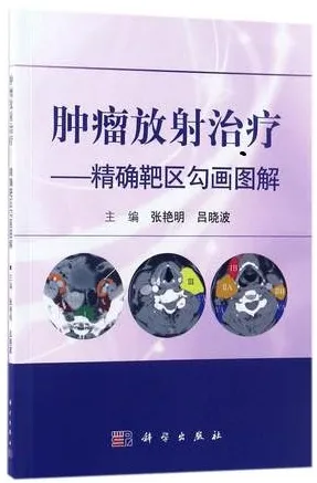 肿瘤放射治疗 精确靶区勾画图解