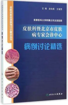皮肤科暨北京市皮肤病专家会诊中心病例讨论精选 首都医科大学附属北京友谊医院