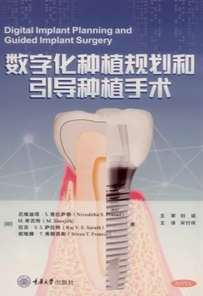 数字化种植规划和引导种植手术