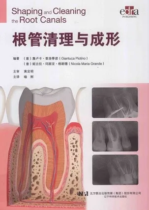 根管清理与成形