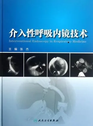 介入性呼吸内镜技术