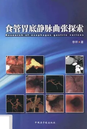 食管胃底静脉曲张探索