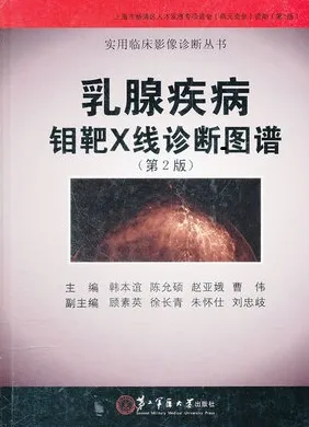 乳腺疾病钼靶X线诊断图谱 第2版