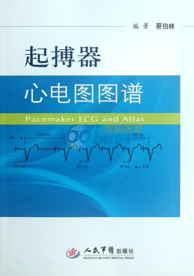 起搏器心电图图谱