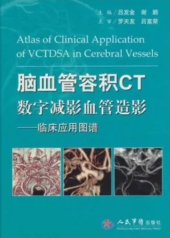 脑血管容积CT数字减影血管造影