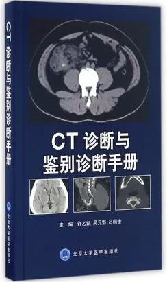 CT诊断与鉴别诊断手册