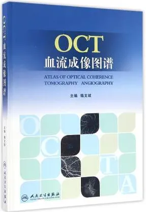 OCT血流成像图谱