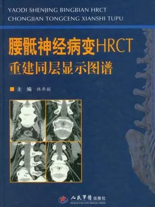 腰骶神经病变HRCT 重建同层显示图谱