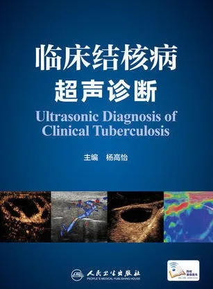 临床结核病超声诊断