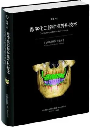 数字化口腔种植外科技术 实现以修复为导向