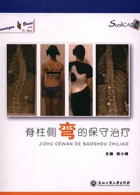 脊柱侧弯的保守治疗
