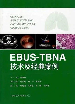 EBUS-TBNA技术及经典案例