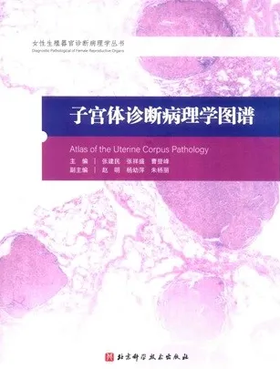 子宫体诊断病理学图谱
