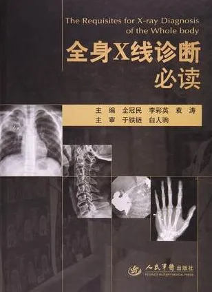 全身X线诊断必读