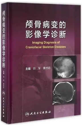 颅骨病变的影像学诊断
