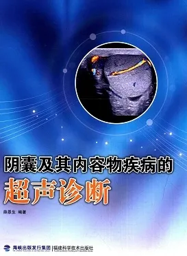 阴囊及其内容物疾病的超声诊断