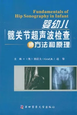 婴幼儿髋关节超声波检查的方法和原理