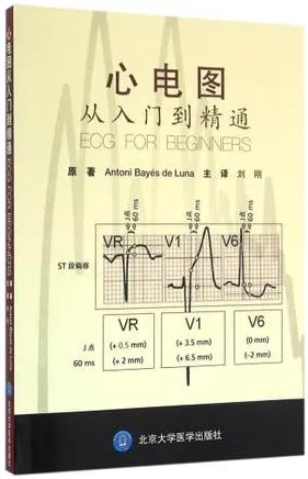 心电图从入门到精通